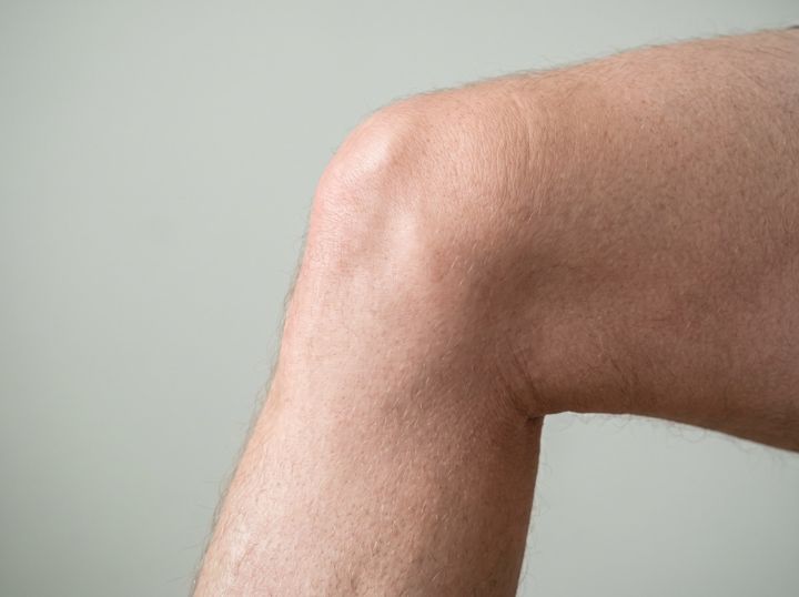 Where to find ST36 on the leg