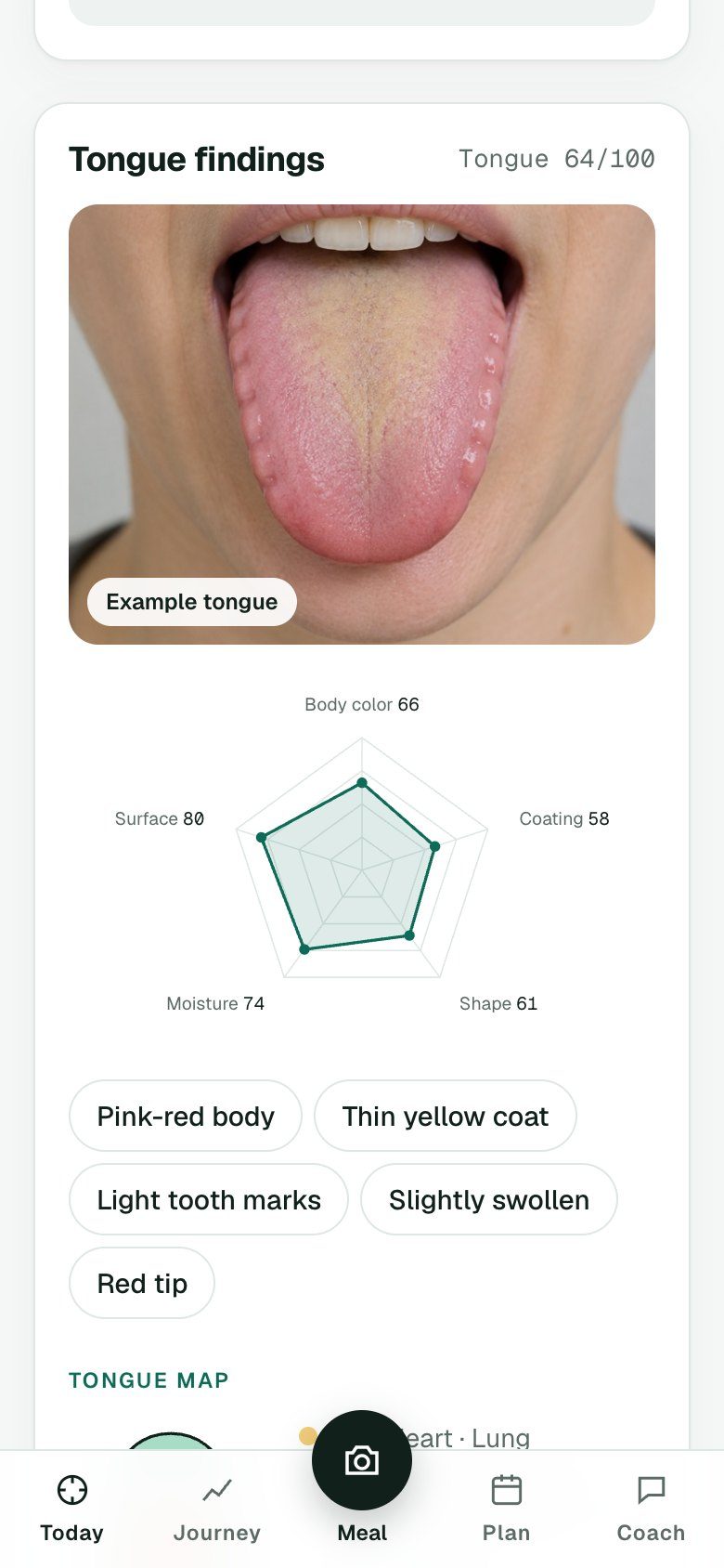 Tongue findings with a radar chart of body color, coating, moisture, shape and surface